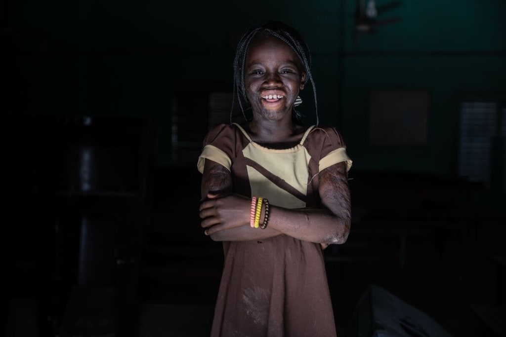 Rihanata pictured smiling with her arms crossed with a dark background. You can see the scars on her face and her arms from her accident.